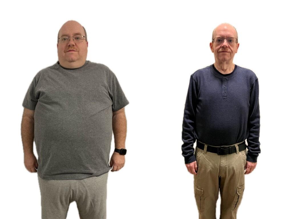 First responder loses 150 pounds with bariatric surgery