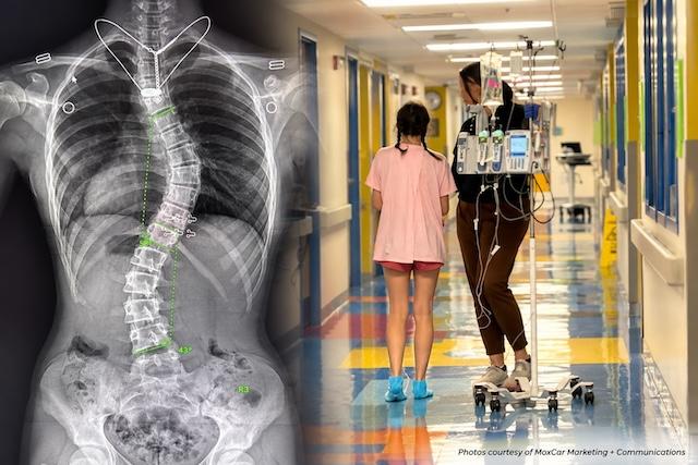 Bearden dancer stands taller after scoliosis surgery